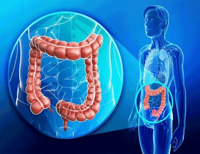 How Lifestyle affects in Increasing Risk of Colon Cancer?