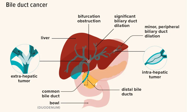 Best HIPEC and Peritoneal Surface Oncologist in New Delhi-Dr.Sanjeev Kumar
